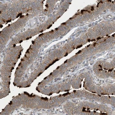 Immunohistochemistry-Paraffin: ZBTB3 Antibody [NBP1-82079]