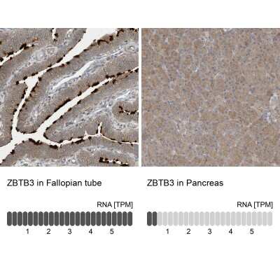 Immunohistochemistry-Paraffin: ZBTB3 Antibody [NBP1-82079]