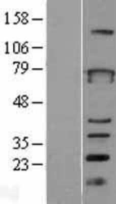 Western Blot: ZBTB3 Overexpression Lysate [NBL1-17968]