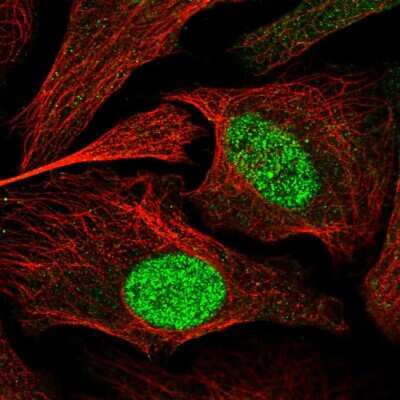 Immunocytochemistry/ Immunofluorescence: ZBTB34 Antibody [NBP1-93562]