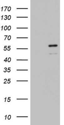 Western Blot: ZBTB37 Antibody (OTI1D7) [NBP2-46396]