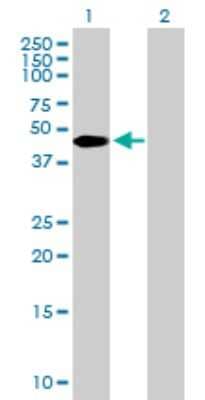 Western Blot: ZBTB37 Antibody [H00084614-B01P]