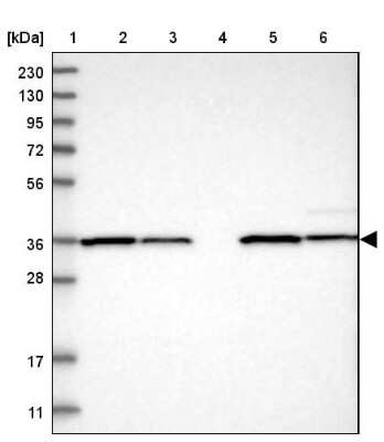 Western Blot: ZBTB37 Antibody [NBP1-81151]