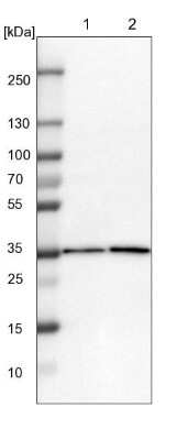 Western Blot: ZBTB37 Antibody [NBP1-81151]