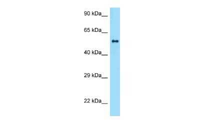 Western Blot: ZBTB37 Antibody [NBP2-88604]