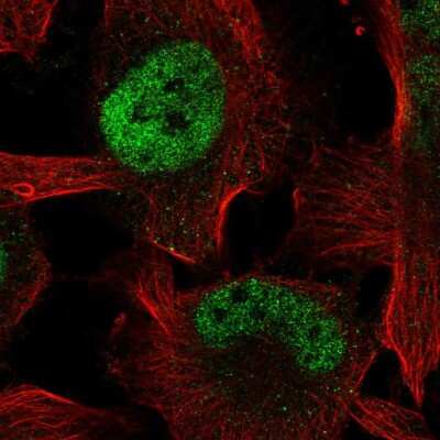 Immunocytochemistry/ Immunofluorescence: ZBTB38 Antibody [NBP2-55733]