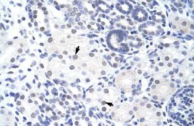 Immunohistochemistry: ZBTB38 Antibody [NBP2-88606]