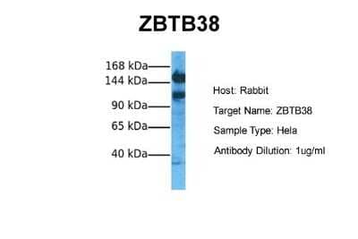 Western Blot: ZBTB38 Antibody [NBP2-88606]