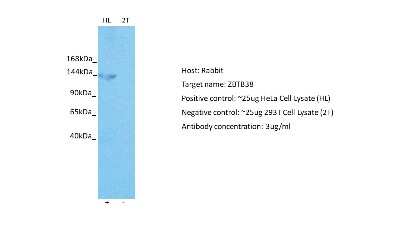 Western Blot: ZBTB38 Antibody [NBP2-88606]