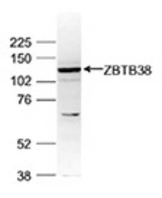 Western Blot: ZBTB38 Antibody [NBP3-18641]