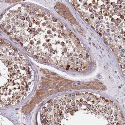 Immunohistochemistry-Paraffin: ZBTB39 Antibody [NBP2-13535]