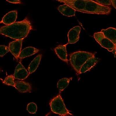 Immunocytochemistry/ Immunofluorescence: ZBTB39 Antibody (PCRP-ZBTB39-1A11) - Azide and BSA Free [NBP3-08799]