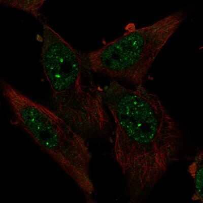 Immunocytochemistry/ Immunofluorescence: ZBTB4 Antibody [NBP2-49425]