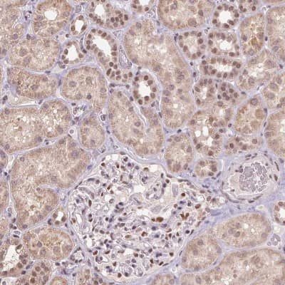 Immunohistochemistry: ZBTB4 Antibody [NBP2-49425]