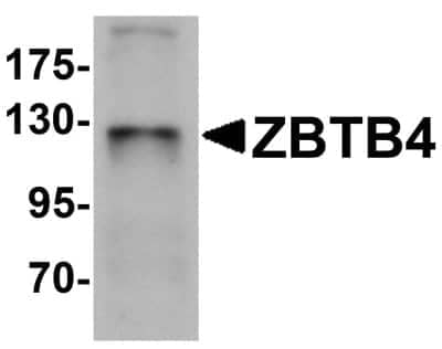 Western Blot: ZBTB4 AntibodyBSA Free [NBP1-76517]