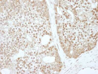 Immunohistochemistry: ZBTB40 Antibody [NBP1-06564]
