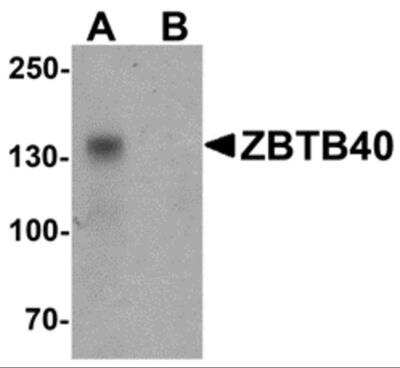 Western Blot: ZBTB40 AntibodyBSA Free [NBP2-81868]