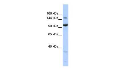 Western Blot: ZBTB40 Antibody [NBP2-84340]