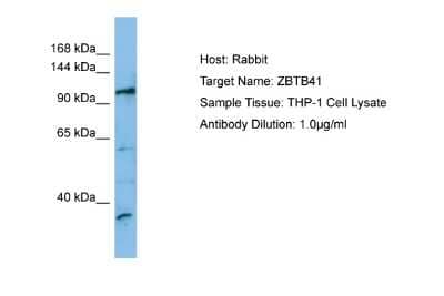 Western Blot: ZBTB41 Antibody [NBP2-86405]