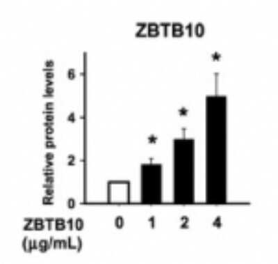 ELISA: ZBTB46 Antibody [NBP2-27211]