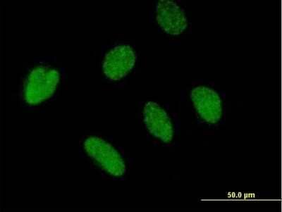 Immunocytochemistry/ Immunofluorescence: ZBTB46 Antibody [H00140685-B01P]