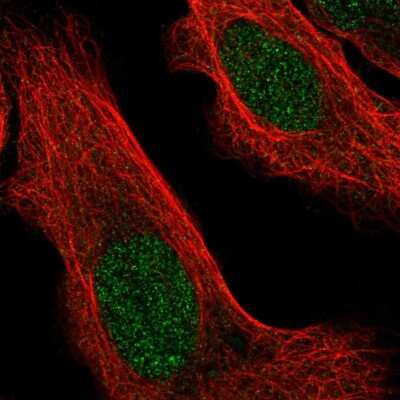 Immunocytochemistry/ Immunofluorescence: ZBTB46 Antibody [NBP1-88506]