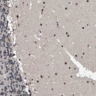 Immunohistochemistry-Paraffin: ZBTB46 Antibody [NBP1-88506]