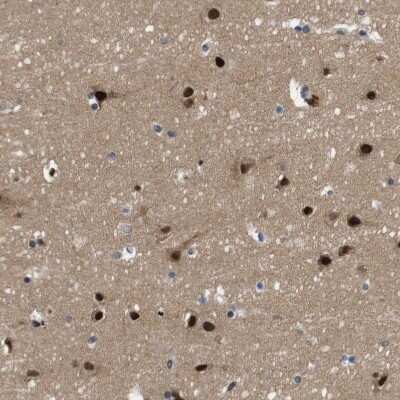 Immunohistochemistry-Paraffin: ZBTB46 Antibody [NBP1-88506]