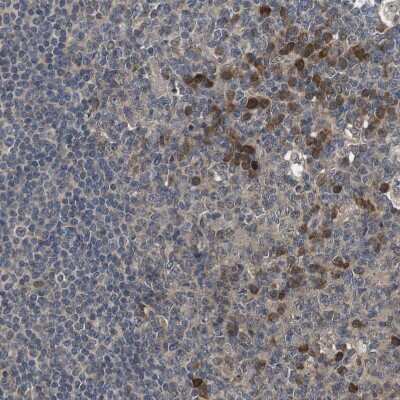 Immunohistochemistry-Paraffin: ZBTB46 Antibody [NBP1-88506]