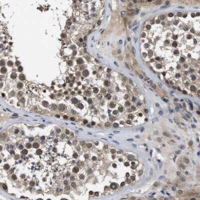 Immunohistochemistry-Paraffin: ZBTB46 Antibody [NBP1-88506]