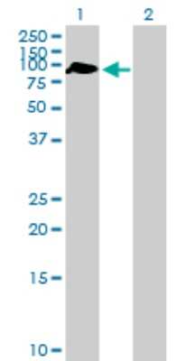 Western Blot: ZBTB46 Antibody [H00140685-B01P]