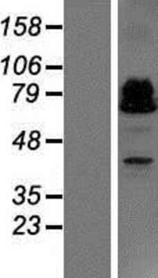 Western Blot: ZBTB46 Overexpression Lysate [NBP2-06207]