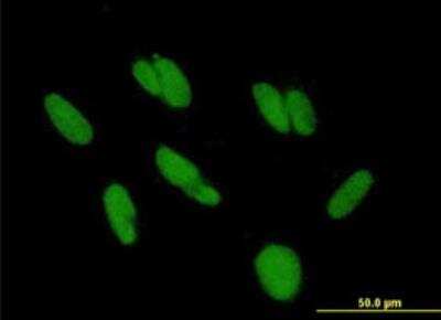 Immunocytochemistry/ Immunofluorescence: ZBTB48 Antibody [H00003104-B01P-50ug]
