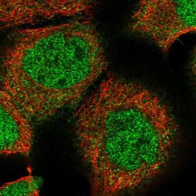 Immunocytochemistry/ Immunofluorescence: ZBTB48 Antibody [NBP1-81740]