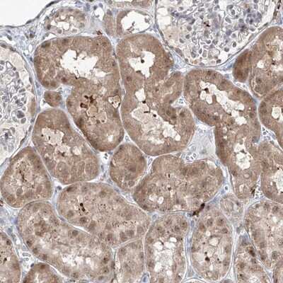 Immunohistochemistry-Paraffin: ZBTB48 Antibody [NBP1-81740]