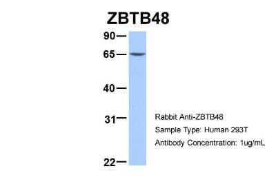 Western Blot: ZBTB48 Antibody [NBP2-88607]