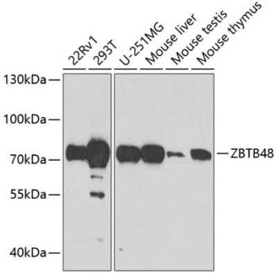 Western Blot: ZBTB48 AntibodyBSA Free [NBP2-93089]