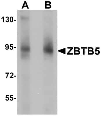 Western Blot: ZBTB5 AntibodyBSA Free [NBP1-76518]