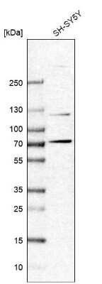 Western Blot: ZBTB5 Antibody [NBP2-13536]