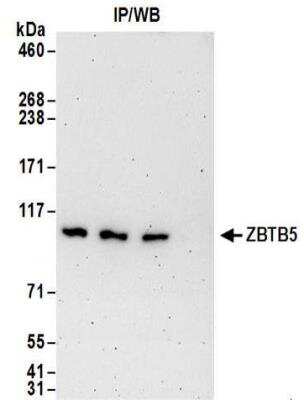 Western Blot: ZBTB5 Antibody [NBP2-32099]