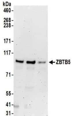 Western Blot: ZBTB5 Antibody [NBP2-32099]