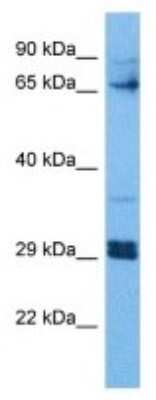 Western Blot: ZBTB5 Antibody [NBP3-09993]