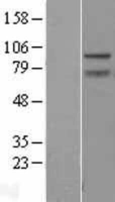 Western Blot: ZBTB5 Overexpression Lysate [NBL1-17976]