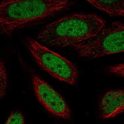 Immunocytochemistry/ Immunofluorescence: ZBTB6 Antibody [NBP2-57411]