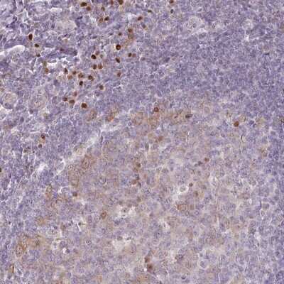 Immunohistochemistry: ZBTB6 Antibody [NBP2-49116]