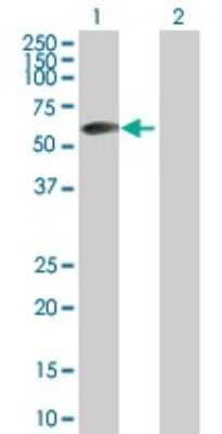 Western Blot: ZBTB6 Antibody [H00010773-B01P]