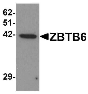 Western Blot: ZBTB6 AntibodyBSA Free [NBP1-76519]