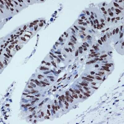 Immunohistochemistry-Paraffin: ZBTB7A/Pokemon Antibody (3T2J1) [NBP3-15914]