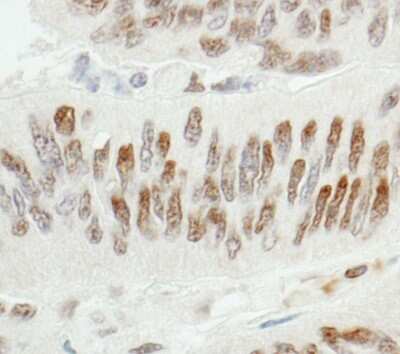 Immunohistochemistry-Paraffin: ZBTB7A/Pokemon Antibody [NB100-762]