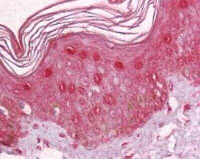 Immunohistochemistry-Paraffin: ZBTB7A/Pokemon Antibody [NBP2-23673]